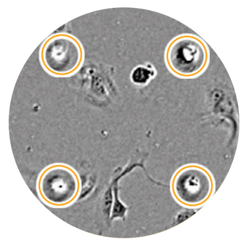 Chemotaxis